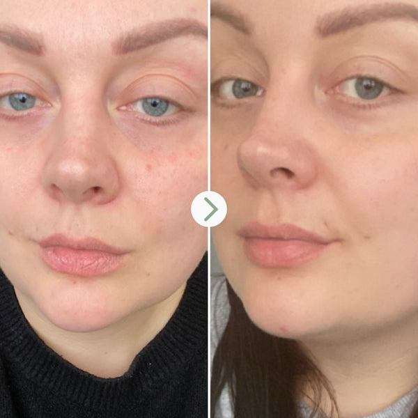 Pai Skincare-Rosehip Bioregenerate-Skincare-5060139722117_5-The Detox Market | 