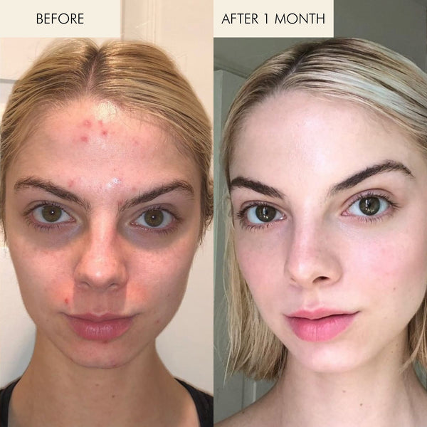 MARA-Evening Primrose + Green Tea Algae Retinol Face Oil-Skincare-MARA-ARO-15_5-The Detox Market | 
