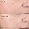 Goop-GOOPGLOW 15% Glycolic Acid Overnight Glow Peel-Skincare-overnightglowpeel_imgCarousel_beforeandafters-The Detox Market | 